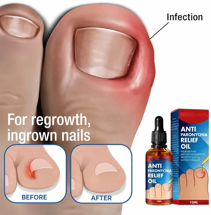 Reparatur beschädigter Nägel | Eingewachsene Nägel & Nagelbett | Hände & Füße | KeraSeal