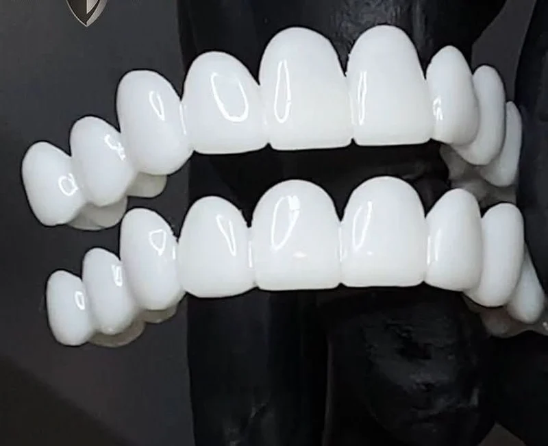 SmileFlex - Anpassbare Zahnprothese mit Dental-Linsen